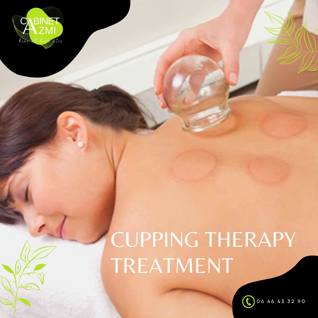 Hijama-cupping thérapie